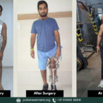 How A Poliotic Patient Got A New Life- Shiv Kishore’s Inspiring Story Of Recovery From Polio Deformity